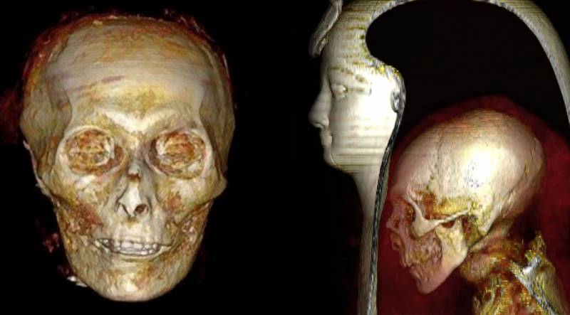 Egypt digitally ‘unwraps’ 3500-year-old mummy of Egyptian king