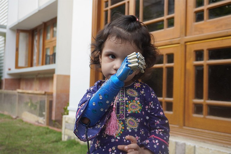 Princess Elsa inspires Momina Aamir in Pakistan to get a blue prosthetic arm